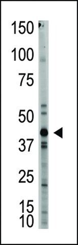 ANTI-MYOSTATIN (GDF8)(N-TERMINAL) antibody produced in rabbit