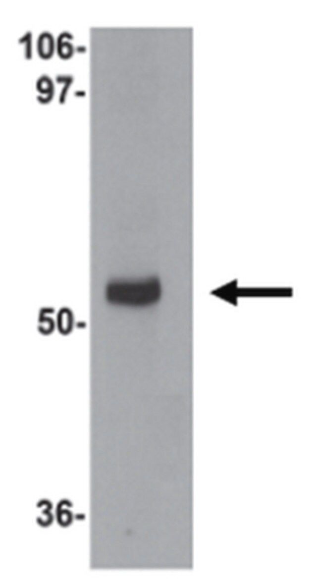 Anti-MYOZAP Antibody