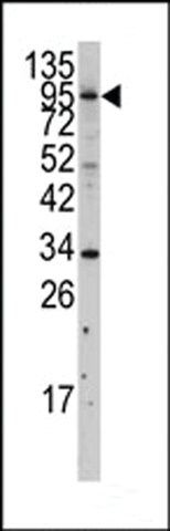 ANTI-MYLK3(N-TERMINAL) antibody produced in rabbit