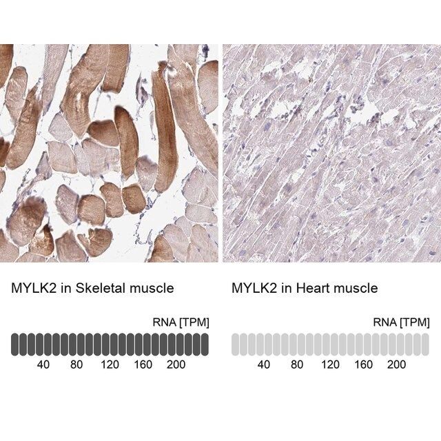 Anti-MYLK2 antibody produced in rabbit