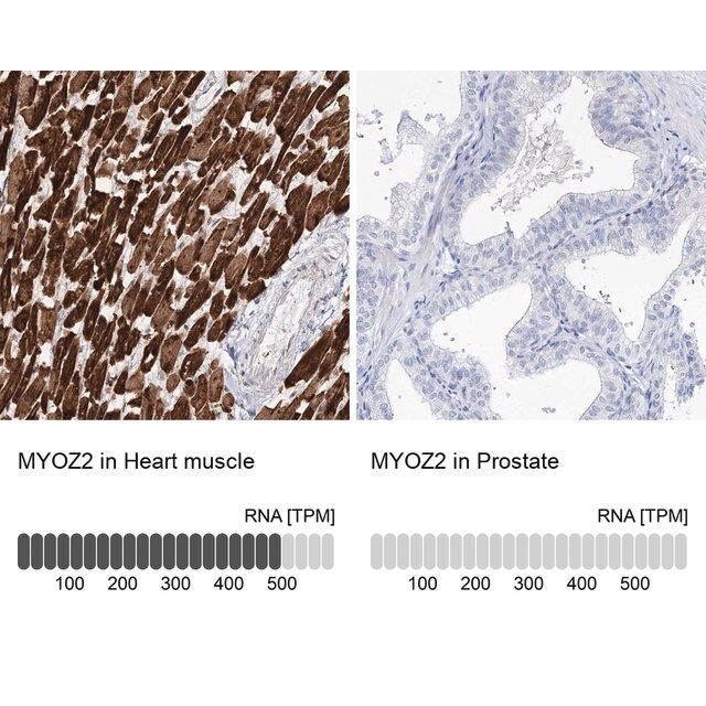 Anti-MYOZ2 antibody produced in rabbit