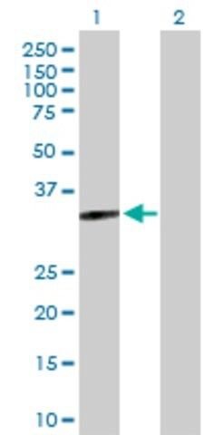 Anti-MYOZ2 antibody produced in rabbit