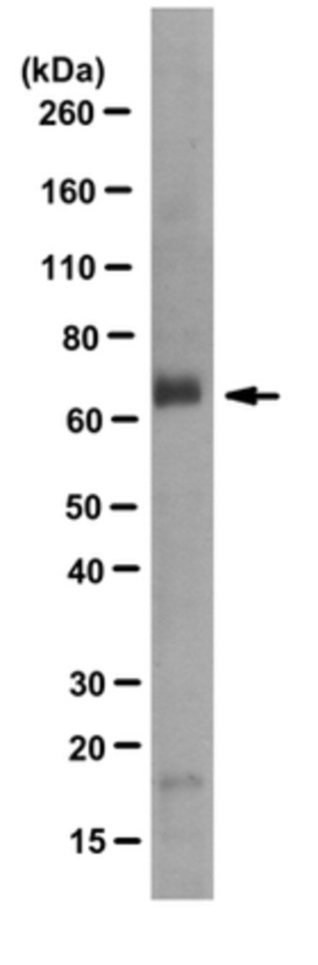 Anti-Myotubularin Antibody, clone 1G6