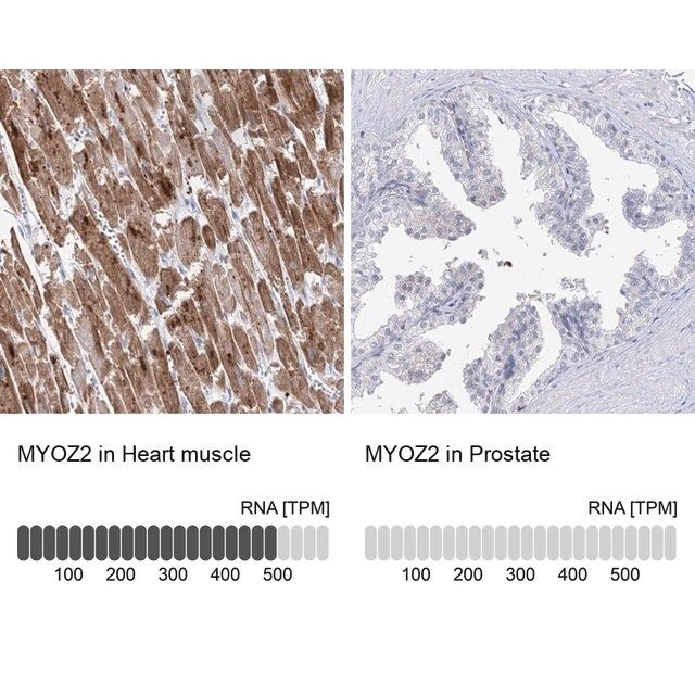 Anti-MYOZ2 antibody produced in rabbit