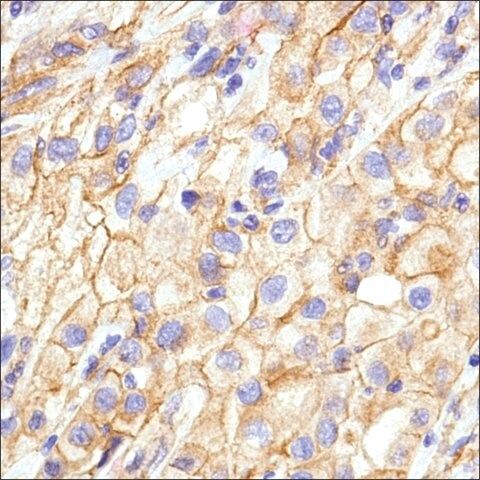 Anti-N-Cadherin, Rabbit monoclonal