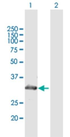 Anti-MYOZ2 antibody produced in mouse