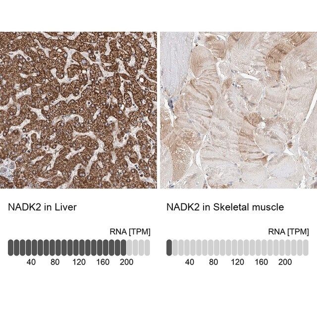 Anti-NADK2 antibody produced in rabbit