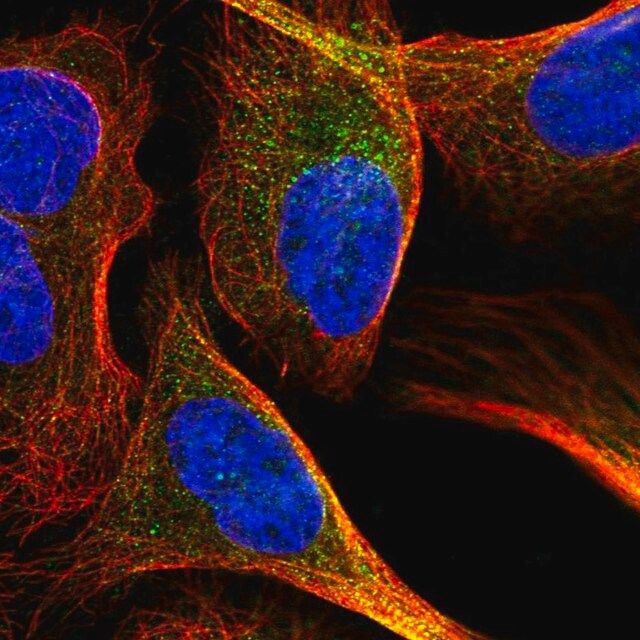 Anti-NAA15 antibody produced in rabbit