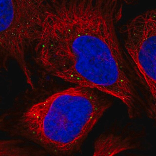 Anti-NAA35 antibody produced in rabbit