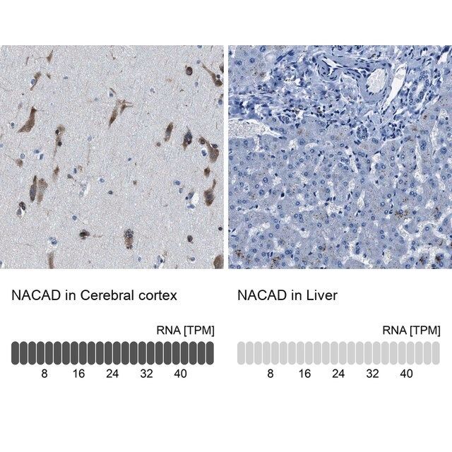 Anti-NACAD antibody produced in rabbit