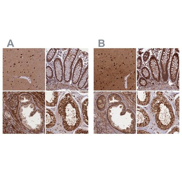 Anti-NAE1 antibody produced in rabbit