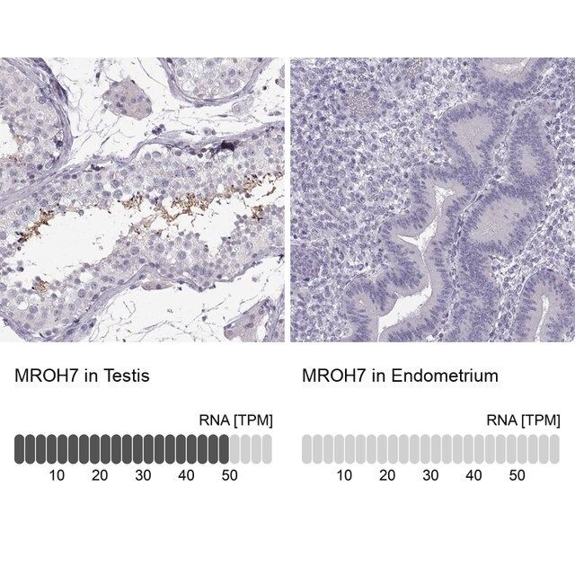 Anti-MROH7