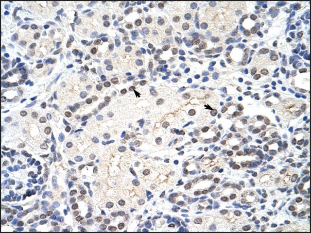 Anti-MRM1 antibody produced in rabbit