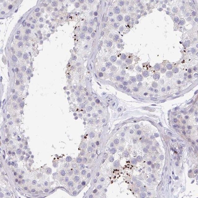 Anti-MROH2B antibody produced in rabbit