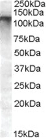 Anti-MRP8/ABCC11 antibody produced in goat