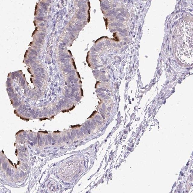 Anti-MROH8 antibody produced in rabbit