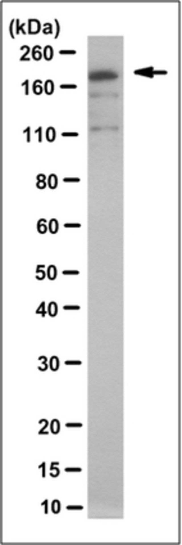 Anti-MRP8 Antibody/ABCC11, clone 2