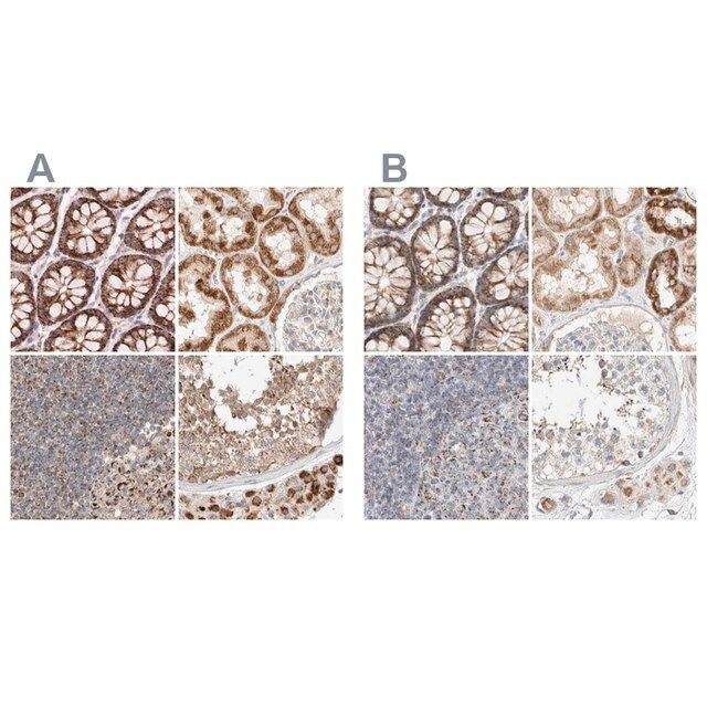 Anti-MRM3 antibody produced in rabbit