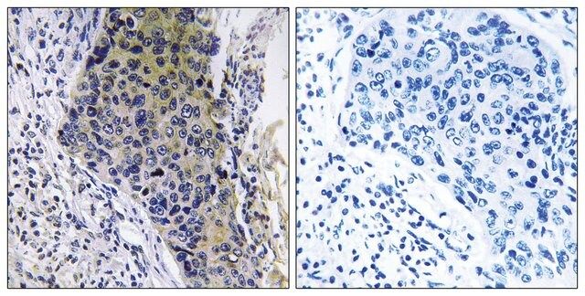 Anti-MRPL34 antibody produced in rabbit