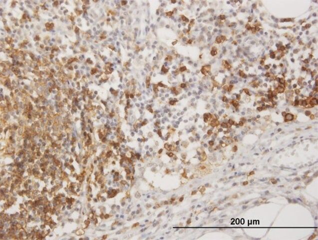 Anti-MS4A1 antibody produced in mouse