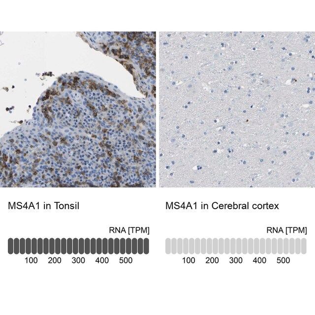 Anti-MS4A1 antibody produced in rabbit