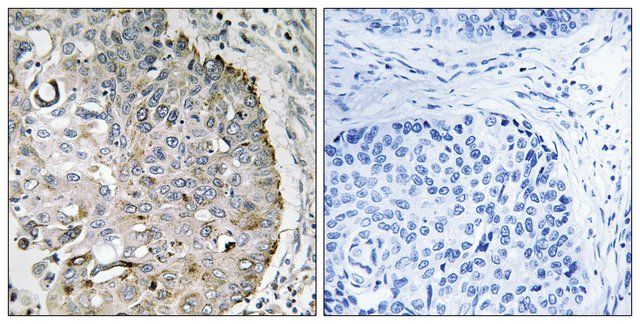 Anti-MRRF antibody produced in rabbit