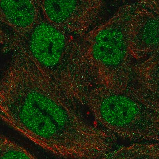 Anti-MTCP1 antibody produced in rabbit