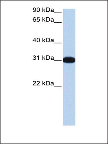 Anti-MBNL2 antibody produced in rabbit