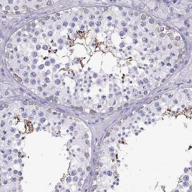 Anti-MC5R antibody produced in rabbit