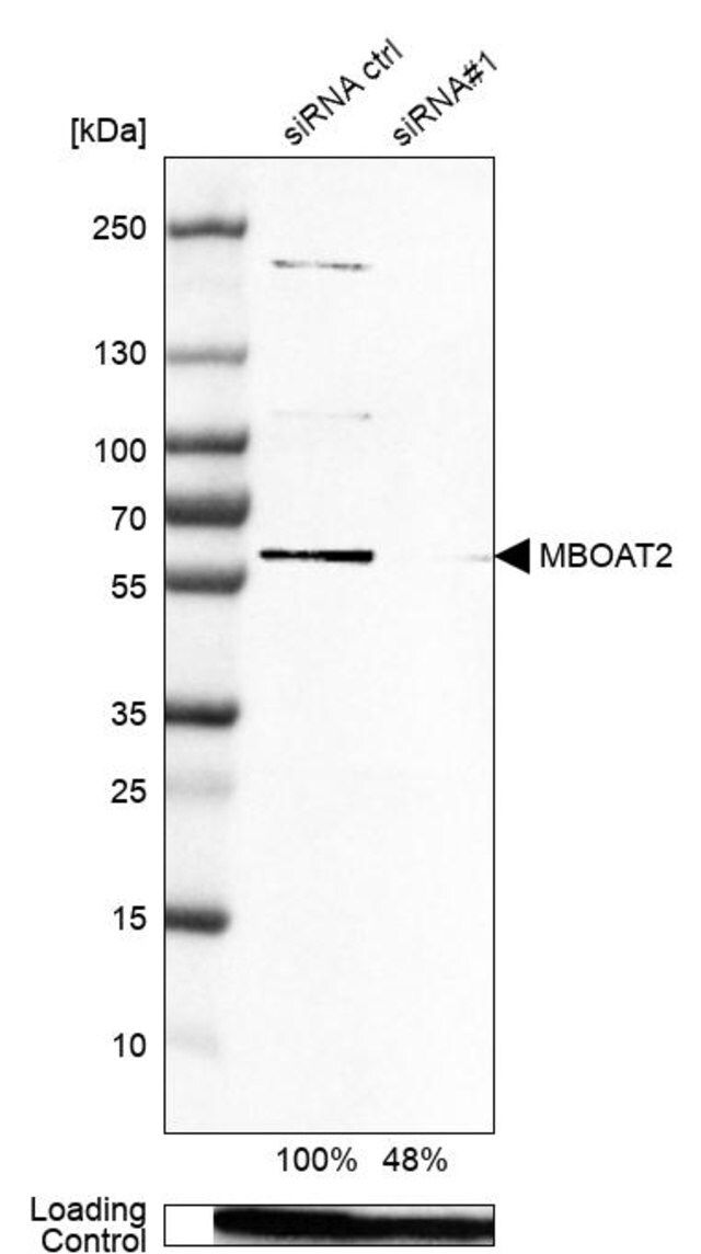 Anti-MBOAT2 antibody produced in rabbit