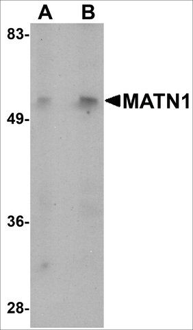 Anti-MATN1 antibody produced in rabbit