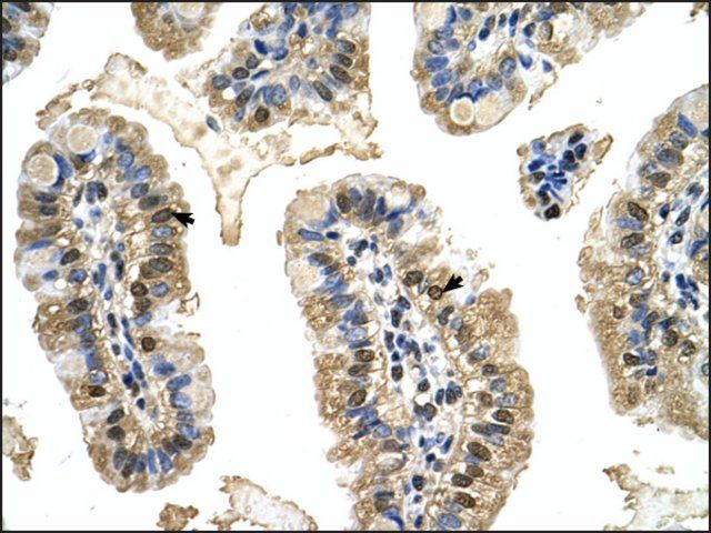 Anti-MCM8 antibody produced in rabbit