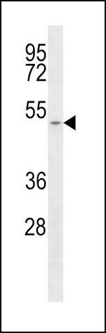 ANTI-MCT1 (SLC16A1)(C-TERMINAL) antibody produced in rabbit