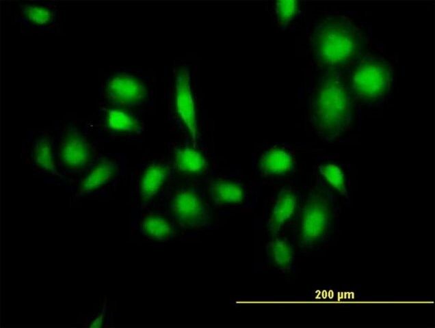 Anti-MDM4 antibody produced in mouse