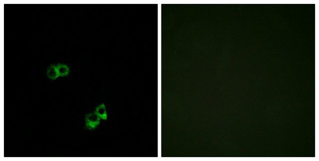 Anti-MC5R antibody produced in rabbit