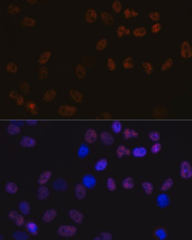 Anti-MCM7 antibody produced in rabbit