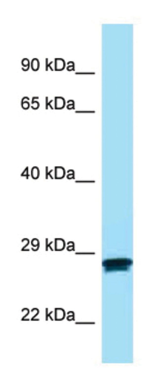 Anti-MC2R (N-terminal) antibody produced in rabbit