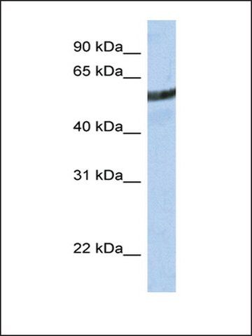 Anti-ME3 antibody produced in rabbit