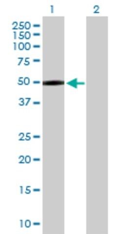 Anti-MASP1 antibody produced in rabbit