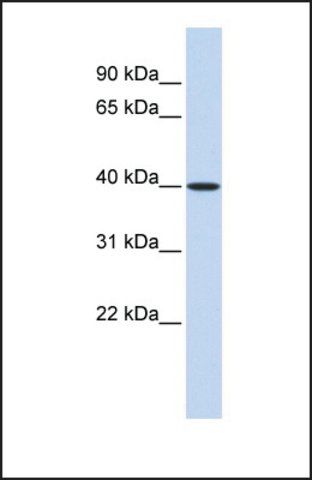 Anti-MAT2B antibody produced in rabbit