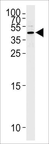 ANTI-MASPIN (CENTER) antibody produced in rabbit