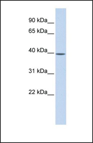 Anti-MAT2B, (N-terminal) antibody produced in rabbit