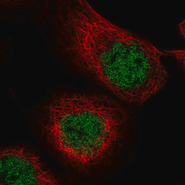 Anti-MASTL antibody produced in rabbit