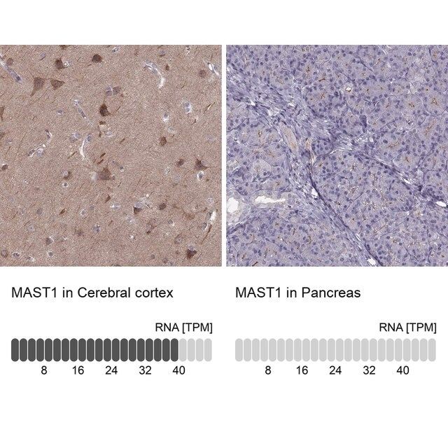 Anti-MAST1