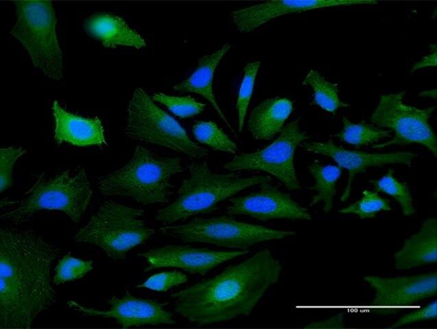 Anti-MASP1 antibody produced in mouse