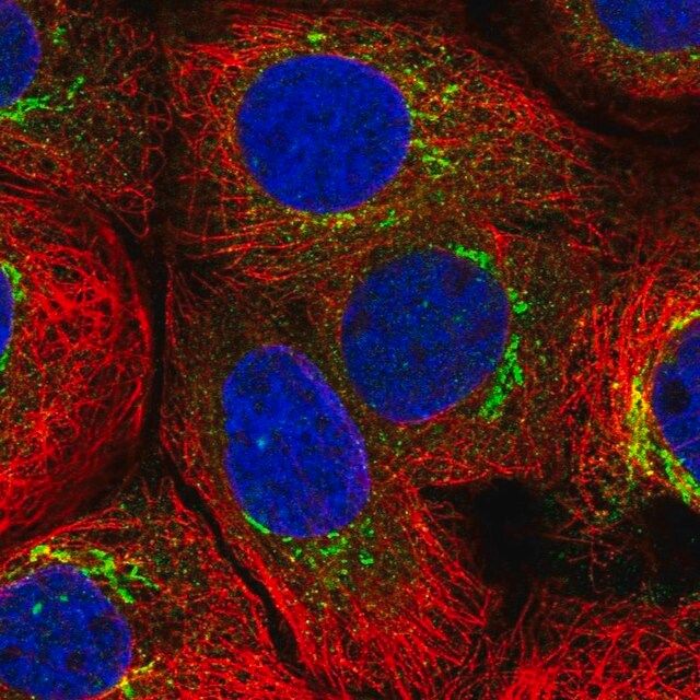 Anti-MATN3 antibody produced in rabbit