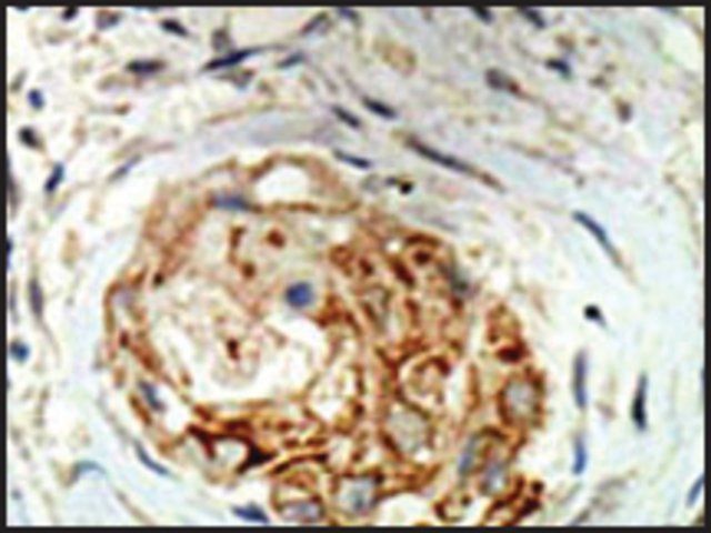 Anti-MBD3 (C-term) antibody produced in rabbit