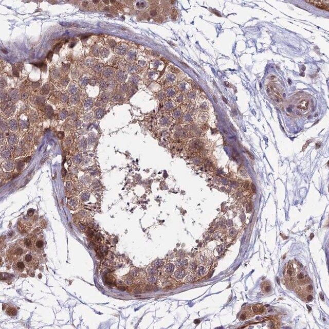 Anti-MAST2 antibody produced in rabbit