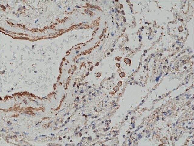 Anti-Matrix metalloproteinase-12 (MMP-12) antibody, Rabbit monoclonal