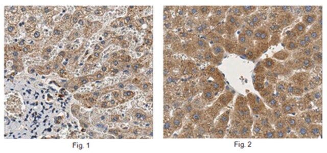 Anti-Matriptase-2/TMPRSS6 Antibody